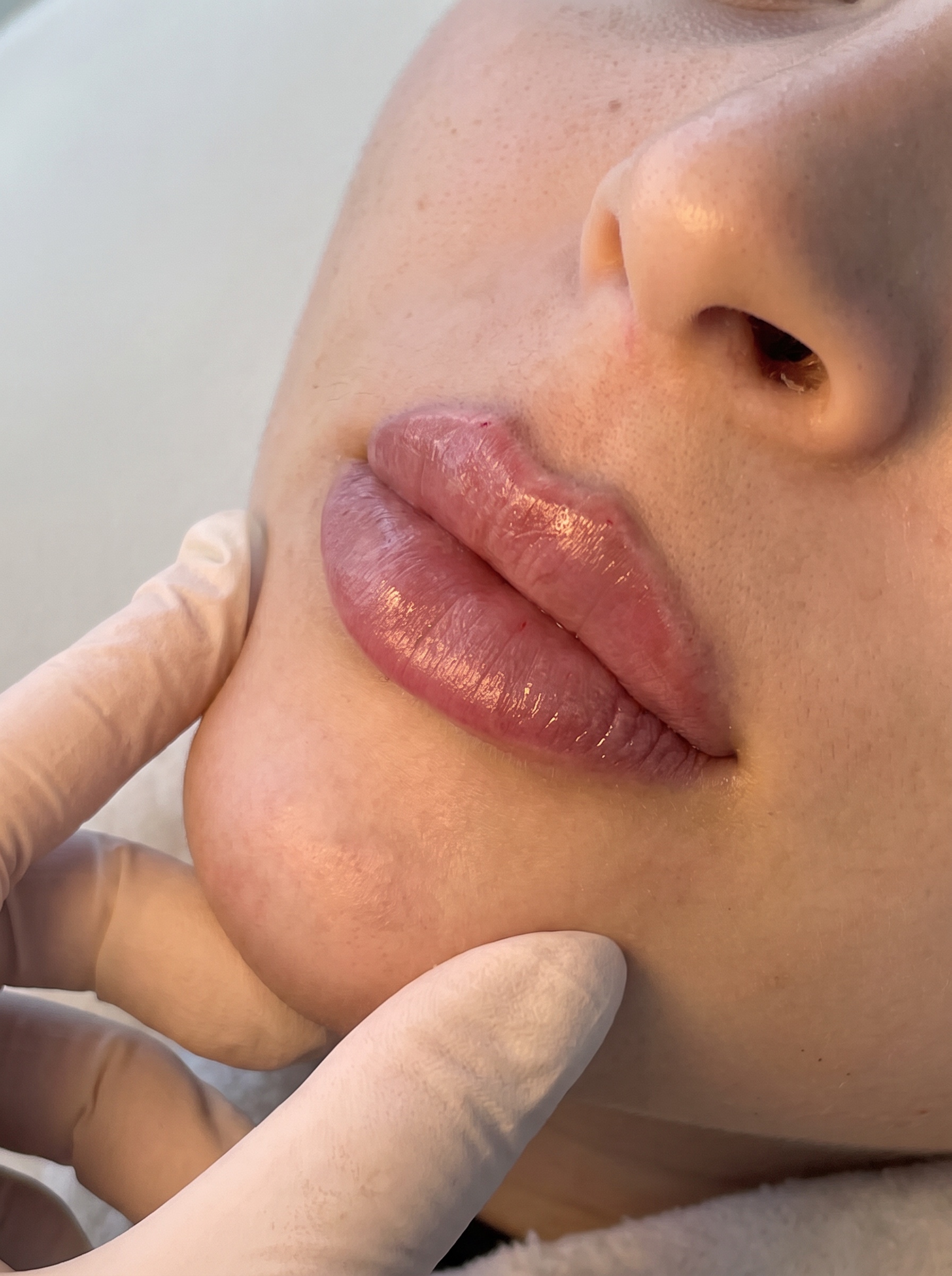 Method Aesthetics in Marylebone London