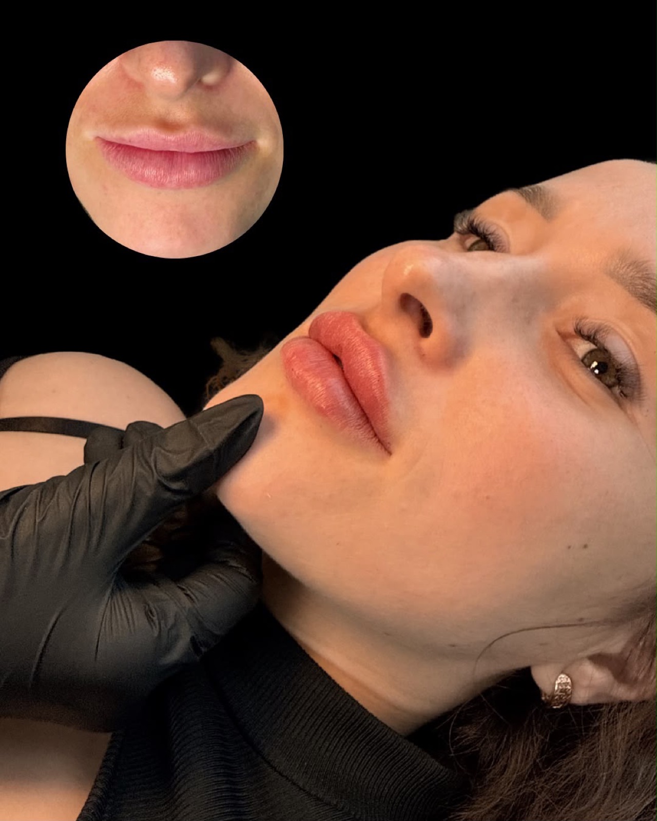 Method Aesthetics in Marylebone London